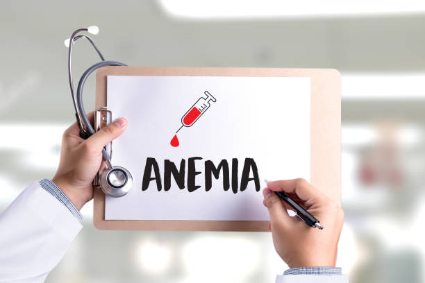 Anaemia, Chronic Disorder Disease Best Treatment and Prescription in South Africa
